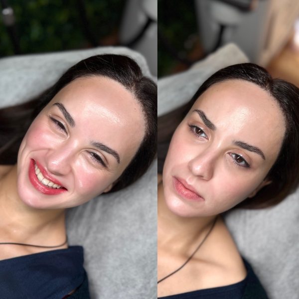 lip tattoo color correction in Brisbane