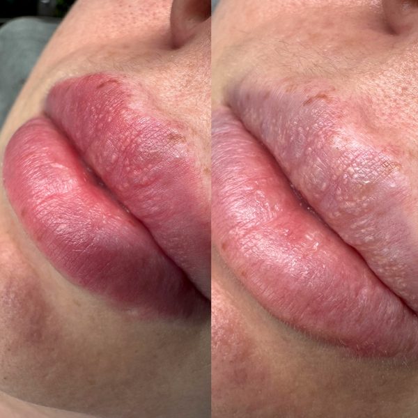 lip tattooing Brisbane