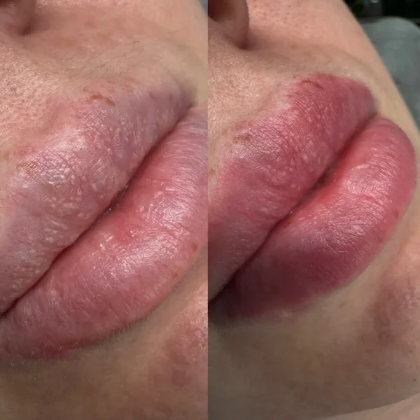 lip tattooing melbourne