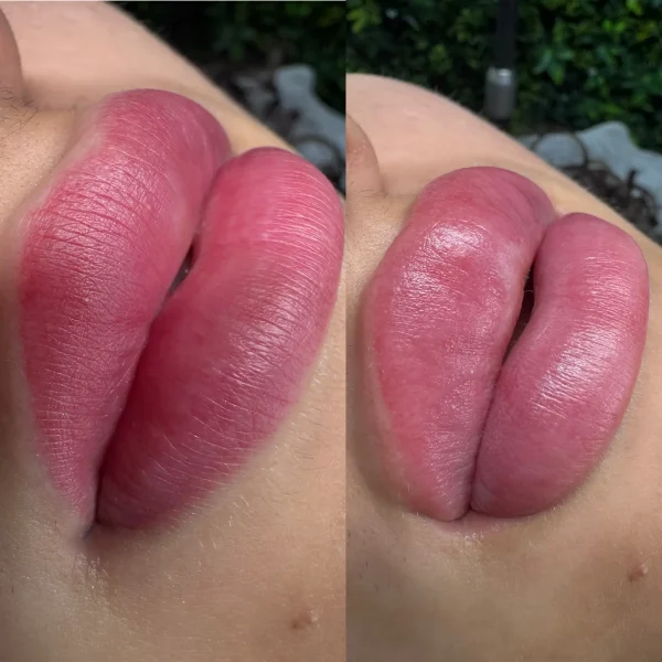 makeup tattoo removal