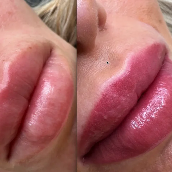 microblading lips
