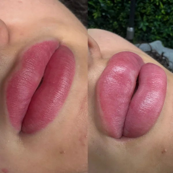 permanent makeup laser removal near me
