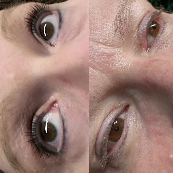 permanent makeup tattoo removal