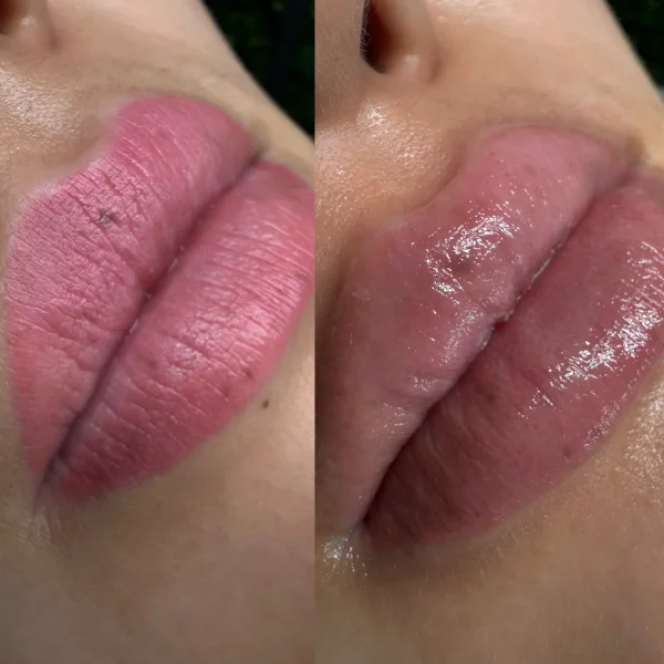 remove cosmetic tattoo