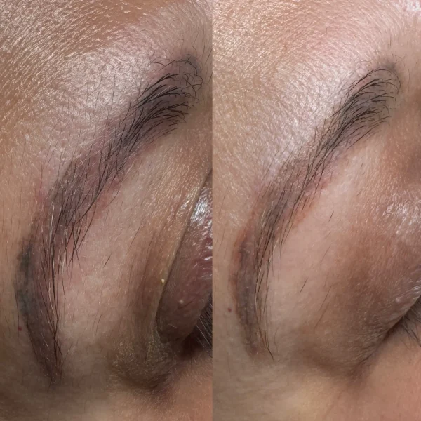 remove permanent makeup