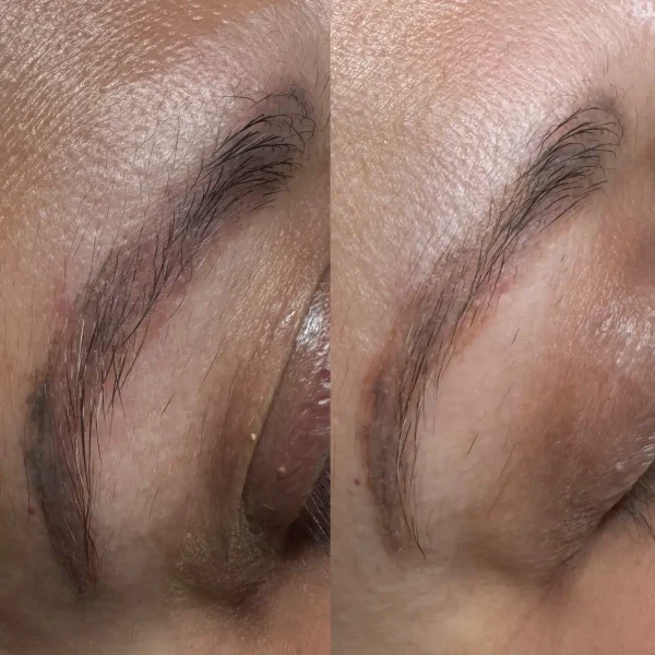 remove permanent makeup