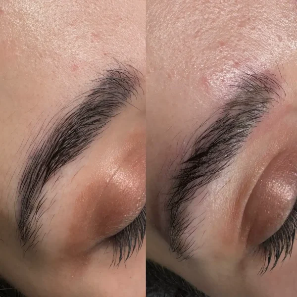 semi permanent makeup removal