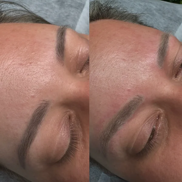 tattoo makeup removal